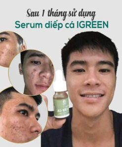 serum trị mụn diếp cá igreen