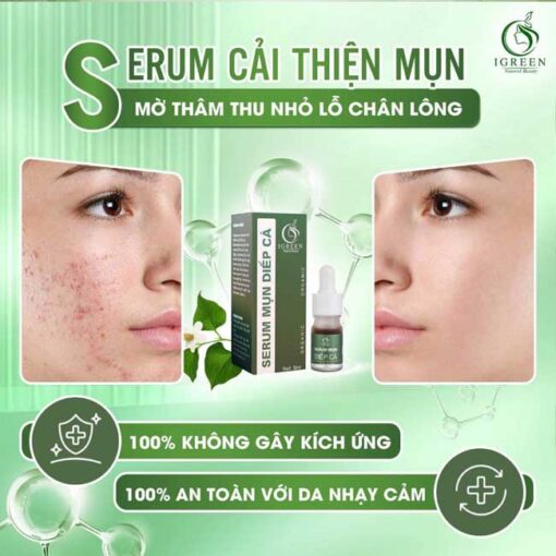 serum trị mụn diếp cá igreen - giải pháp tự nhiên cho làn da sáng khỏe, không tì vết